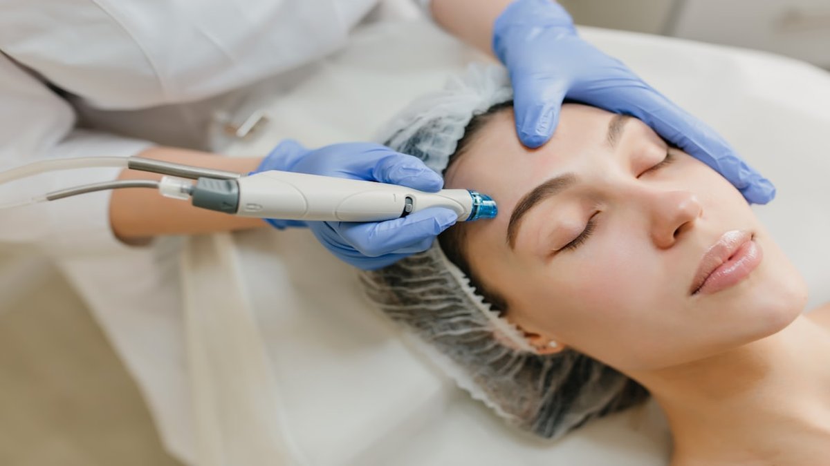 clinical microneedling protocol step by step