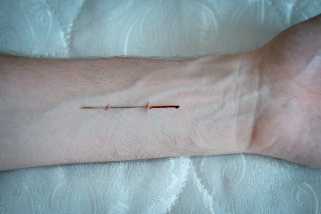 needle depth by skin type