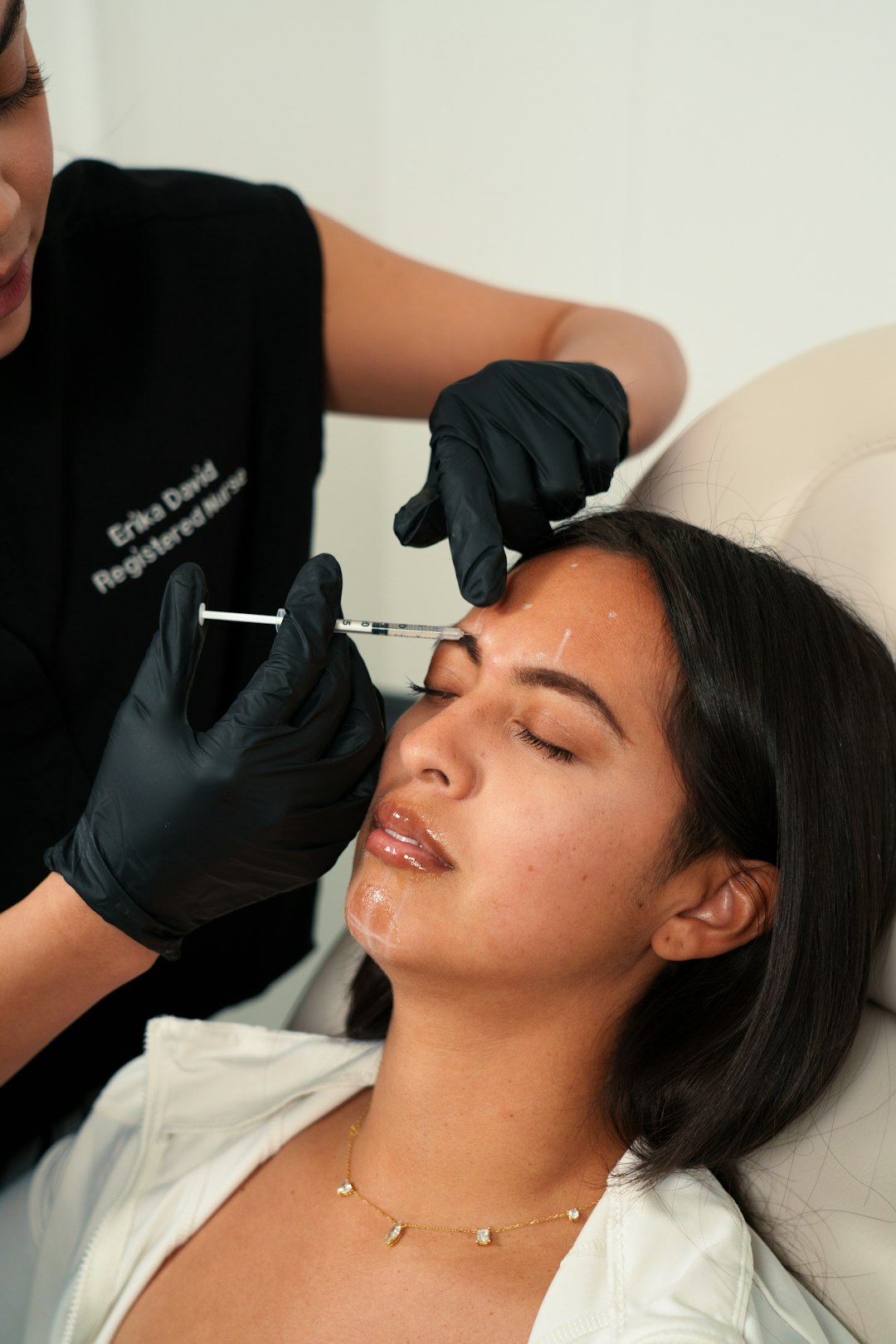 microneedling skin response and skin clinic